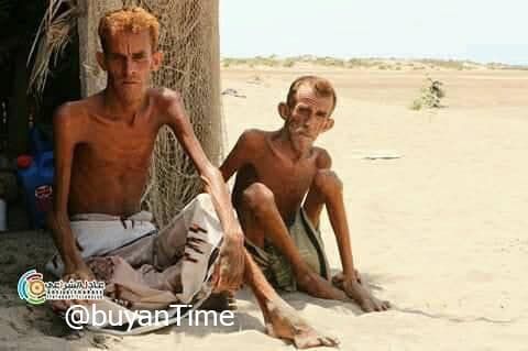 Yemen, 400 mila bambini a rischio malnutrizione nel 2021